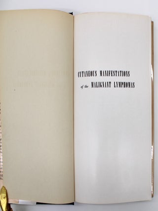 Item #1016 Cutaneous Manifestations of the Malignant Lymphomas. Samuel Bluefarb