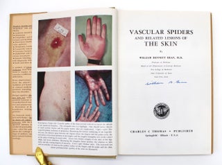 Item #1018 Vascular Spiders and Related Lesions of the Skin. William Bennett Bean