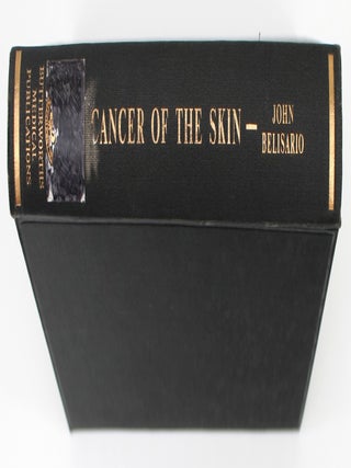 Cancer of the Skin