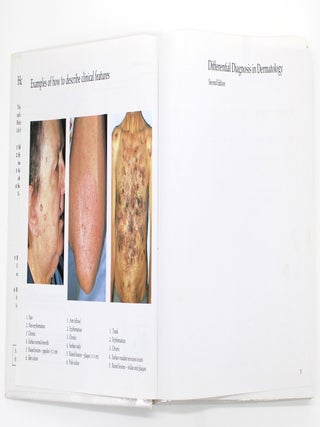 Differential Diagnosis in Dermatology