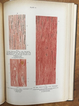 The Healing of Nerves