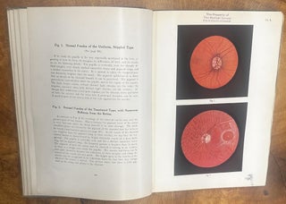 Ophthalmoscopic Diagnosis
