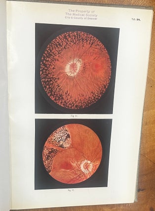 Ophthalmoscopic Diagnosis