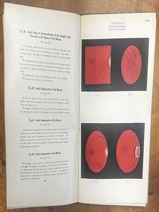 Ophthalmoscopic Diagnosis