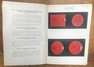 Ophthalmoscopic Diagnosis