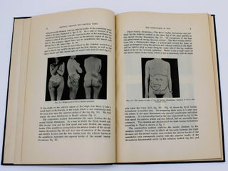 The Dermatomes in Man