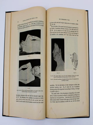 The Dermatomes in Man