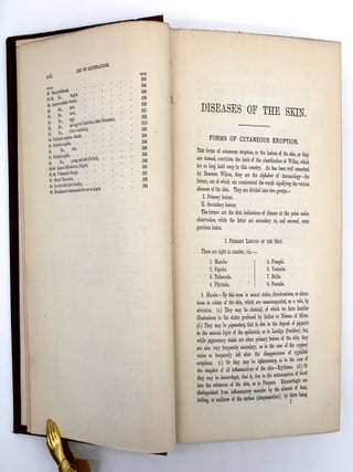 A Treatise on Diseases of the Skin with Special Reference to Their Diagnosis and Treatment, Including an Analysis of 11,000 Consecutive Cases