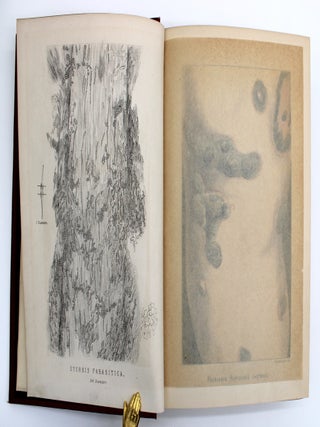 A Treatise on Diseases of the Skin with Special Reference to Their Diagnosis and Treatment, Including an Analysis of 11,000 Consecutive Cases