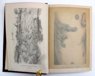 A Treatise on Diseases of the Skin with Special Reference to Their Diagnosis and Treatment, Including an Analysis of 11,000 Consecutive Cases